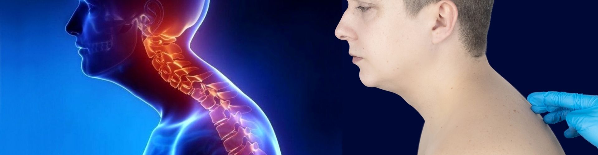 درمان قوز پشت بدون جراحی در متالایف